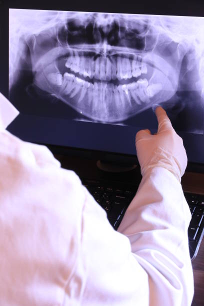 Best Emergency Treatment for Dental Infections or Abscesses in North Highlands, CA